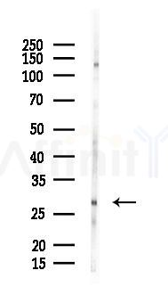 STAR Antibody - Western blot analysis of lysates from B16F10-LUC cells(heat-shock 45min treatment), using STAR Antibody at 1/1000 dilution.