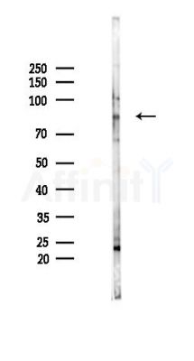 Alkaline Phosphatase Antibody - Western blot analysis of lysates from B16F10-LUC cells(LPS 4h treatment), using Alkaline Phosphatase Antibody at 1/1000 dilution.