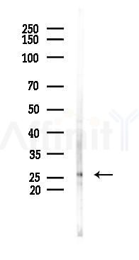 FAM3B Antibody - Western blot analysis of lysates from HUVEC cells(starvation 24h treatment), using FAM3B Antibody at 1/1000 dilution.