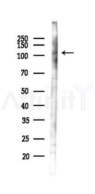 ATP2A2 Antibody - Western blot analysis of lysates from 293 cells(heat-shock 45min treatment), using ATP2A2 Antibody at 1/1000 dilution.
