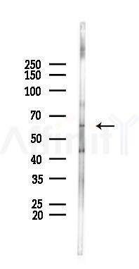 TCF4 Antibody - Western blot analysis of lysates from Rat brain, using TCF4 Antibody at 1/1000 dilution.