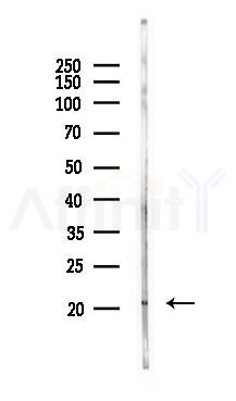 FTH1 Antibody - Western blot analysis of lysates from Mouse liver, using FTH1 Antibody at 1/1000 dilution.