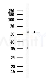 TICAM1 Antibody - Western blot analysis of lysates from Mouse brain, using TICAM1 Antibody at 1/1000 dilution.