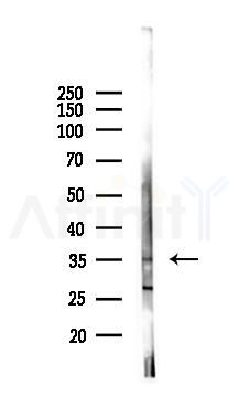 CD86 Antibody - Western blot analysis of lysates from Rat brain, using CD86 Antibody at 1/1000 dilution.