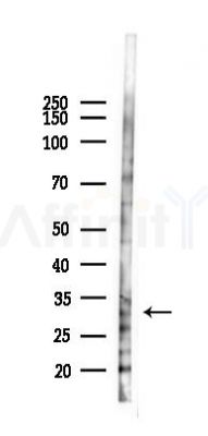 ECI1 Antibody - Western blot analysis of lysates from PC12 cells(heat-shock 45min treatment), using ECI1 Antibody at 1/1000 dilution.