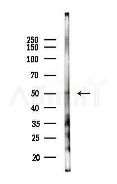 SELENBP1 Antibody - Western blot analysis of lysates from Hela cells(heat-shock 45min treatment), using SELENBP1 Antibody at 1/1000 dilution.