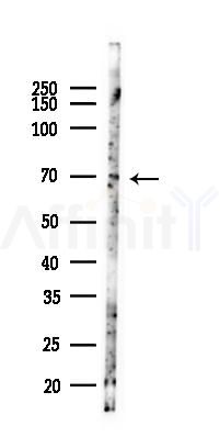 IL7R Antibody - Western blot analysis of lysates from Hela cells(heat-shock 45min treatment), using IL7R Antibody at 1/1000 dilution.