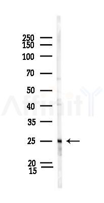 CD3D Antibody - Western blot analysis of lysates from Rat testis, using CD3D Antibody at 1/1000 dilution.