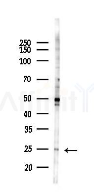 CD3D Antibody - Western blot analysis of lysates from 293 cells(heat-shock 45min treatment), using CD3D Antibody at 1/1000 dilution.