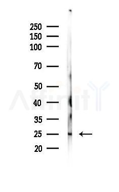 BDNF Antibody - Western blot analysis of lysates from COLO205 cells(UV 30min treatment), using BDNF Antibody at 1/1000 dilution.