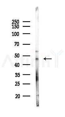 OGG1 Antibody - Western blot analysis of lysates from Hela cells(heat-shock 45min treatment), using OGG1 Antibody at 1/1000 dilution.