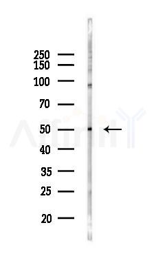 HLA-DPB1 Antibody - Western blot analysis of lysates from Hela cells(heat-shock 45min treatment), using HLA-DPB1 Antibody at 1/1000 dilution.
