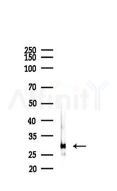 NQO1 Antibody - Western blot analysis of lysates from A2780 cells(LPS 4h treatment), using NQO1 Antibody at 1/1000 dilution.