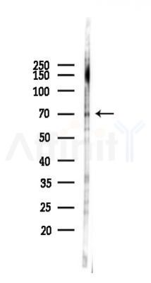 PRMT5 Antibody - Western blot analysis of lysates from 293 cells(LPS 4h treatment), using PRMT5 Antibody at 1/1000 dilution.