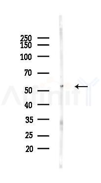 SERPINC1 Antibody - Western blot analysis of lysates from Rat muscle, using SERPINC1 Antibody at 1/1000 dilution.