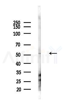 SERPINC1 Antibody - Western blot analysis of lysates from Hela cells(heat-shock 45min treatment), using SERPINC1 Antibody at 1/1000 dilution.