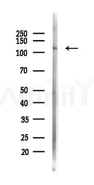 ADD1 Antibody - Western blot analysis of lysates from COLO205 cells(heat-shock 45min treatment), using ADD1 Antibody at 1/1000 dilution.