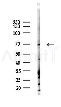 IL23R Antibody - Western blot analysis of lysates from HUVEC cells(LPS 4h treatment), using IL23R Antibody at 1/1000 dilution.