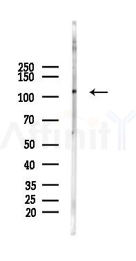 DPYD Antibody - Western blot analysis of lysates from Rat kidney, using DPYD Antibody at 1/1000 dilution.