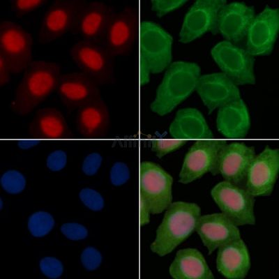 ETV6 / Tel Antibody - DF6521 staining Hela cells(30min of UV treatment) by IF/ICC.
