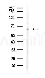 HNRNPK Antibody - Western blot analysis of lysates from COLO205 cells(heat-shock 45min treatment), using HNRNPK Antibody at 1/1000 dilution.