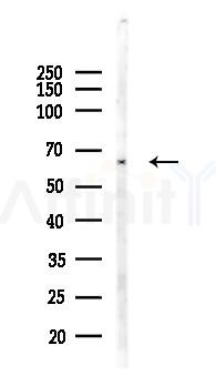 HNRNPK Antibody - Western blot analysis of lysates from Hela cells(LPS 4h treatment), using HNRNPK Antibody at 1/1000 dilution.