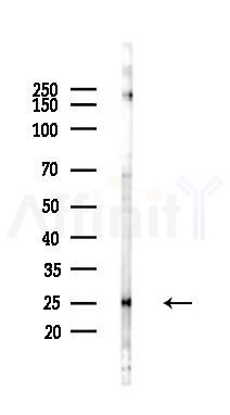 POLR2E Antibody - Western blot analysis of lysates from HUVEC cells(LPS 4h treatment), using POLR2E Antibody at 1/1000 dilution.