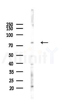 CDH13 Antibody - Western blot analysis of lysates from Hela cells(heat-shock 45min treatment), using CDH13 Antibody at 1/1000 dilution.