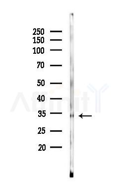 CTSK Antibody - Western blot analysis of lysates from Rat liver, using CTSK Antibody at 1/1000 dilution.