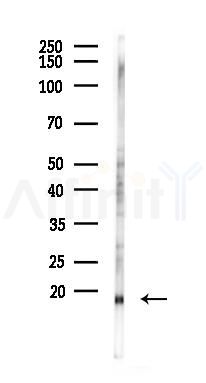 RBX1 Antibody - Western blot analysis of lysates from COLO205 cells(heat-shock 45min treatment), using RBX1 Antibody at 1/1000 dilution.