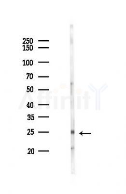 ATF3 Antibody - Western blot analysis of lysates from Rat kidney, using ATF3 Antibody at 1/1000 dilution.