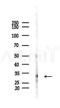 SLC25A4 Antibody - Western blot analysis of lysates from HUVEC cells(LPS 4h treatment), using SLC25A4 Antibody at 1/1000 dilution.