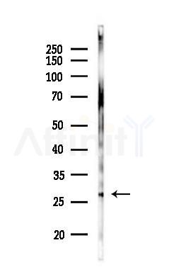 RAB27A Antibody - Western blot analysis of lysates from Mouse brain, using RAB27A Antibody at 1/1000 dilution.