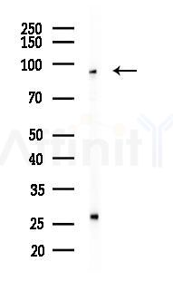 MCM6 Antibody - Western blot analysis of lysates from COLO205 cells(heat-shock 45min treatment), using MCM6 Antibody at 1/1000 dilution.