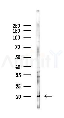 RPS27A Antibody - Western blot analysis of lysates from 293 cells(heat-shock 45min treatment), using RPS27A Antibody at 1/1000 dilution.