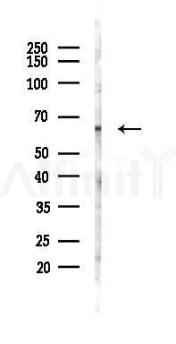cdc45 Antibody - Western blot analysis of lysates from COLO205 cells(heat-shock 45min treatment), using cdc45 Antibody at 1/1000 dilution.