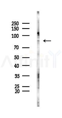 CCNT1 Antibody - Western blot analysis of lysates from PC12 cells(UV 30min treatment), using CCNT1 Antibody at 1/1000 dilution.