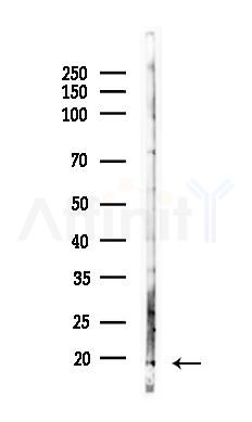 IL13 Antibody - Western blot analysis of lysates from HUVEC cells(LPS 4h treatment), using IL13 Antibody at 1/1000 dilution.