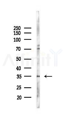 PPA1 Antibody - Western blot analysis of lysates from 293 cells(heat-shock 45min treatment), using PPA1 Antibody at 1/1000 dilution.