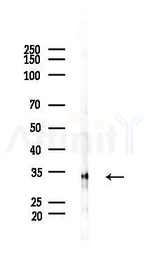 Caspase 3 Antibody - Western blot analysis of lysates from PC12 cells(starvation 24h treatment), using Caspase 3 Antibody at 1/1000 dilution.