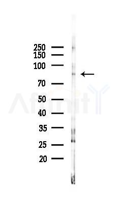 5 Lipoxygenase Antibody - Western blot analysis of lysates from B16F10-LUC cells(heat-shock 45min treatment), using 5 Lipoxygenase Antibody at 1/1000 dilution.