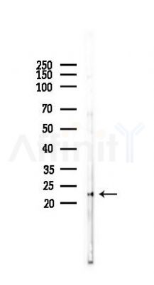 IL10 Antibody - Western blot analysis of lysates from Rat lung, using IL10 Antibody at 1/1000 dilution.