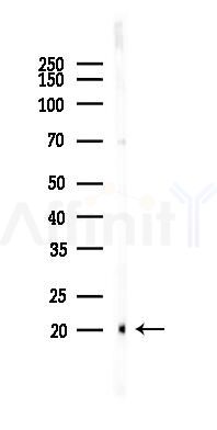 BIK Antibody - Western blot analysis of lysates from Hela cells(heat-shock 45min treatment), using BIK Antibody at 1/1000 dilution.