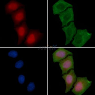 BIK Antibody - DF6958 staining Hela cells(45min of heat-shock treatment) by IF/ICC.