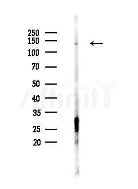 ACK1 Antibody - Western blot analysis of lysates from PC12 cells(heat-shock 45min treatment), using ACK1 Antibody at 1/1000 dilution.