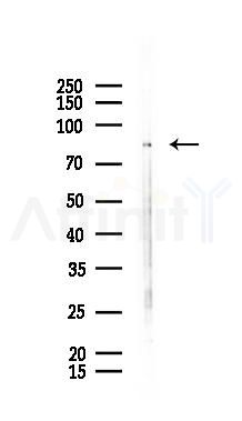 DRP1 Antibody - Western blot analysis of lysates from Mouse lung, using DRP1 Antibody at 1/1000 dilution.