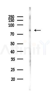 DRP1 Antibody - Western blot analysis of lysates from Rat liver, using DRP1 Antibody at 1/1000 dilution.