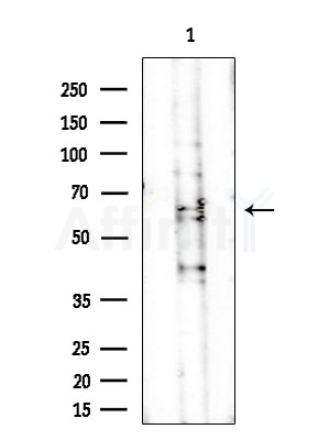 DBH Antibody - Western blot analysis of lysates from Mouse testis, using DBH Antibody at 1/1000 dilution.