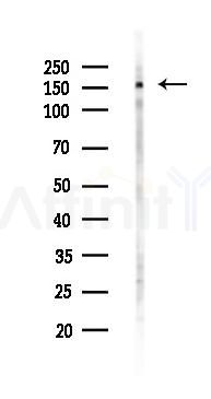 PELP1 Antibody - Western blot analysis of lysates from PC12 cells(heat-shock 45min treatment), using PELP1 Antibody at 1/1000 dilution.