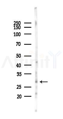 GMNN Antibody - Western blot analysis of lysates from Hela cells(heat-shock 45min treatment), using GMNN Antibody at 1/1000 dilution.